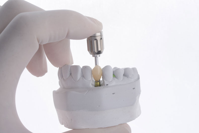 a single dental implant with a tool top being shown