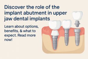 Image showcasing the anatomy of dental implants in the upper jaw, highlighting the implant placement within the bone structure, the abutment connecting the implant to the crown, and the proximity to the sinus cavity. No text on the image.